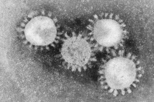 Que sont les infections virales ?